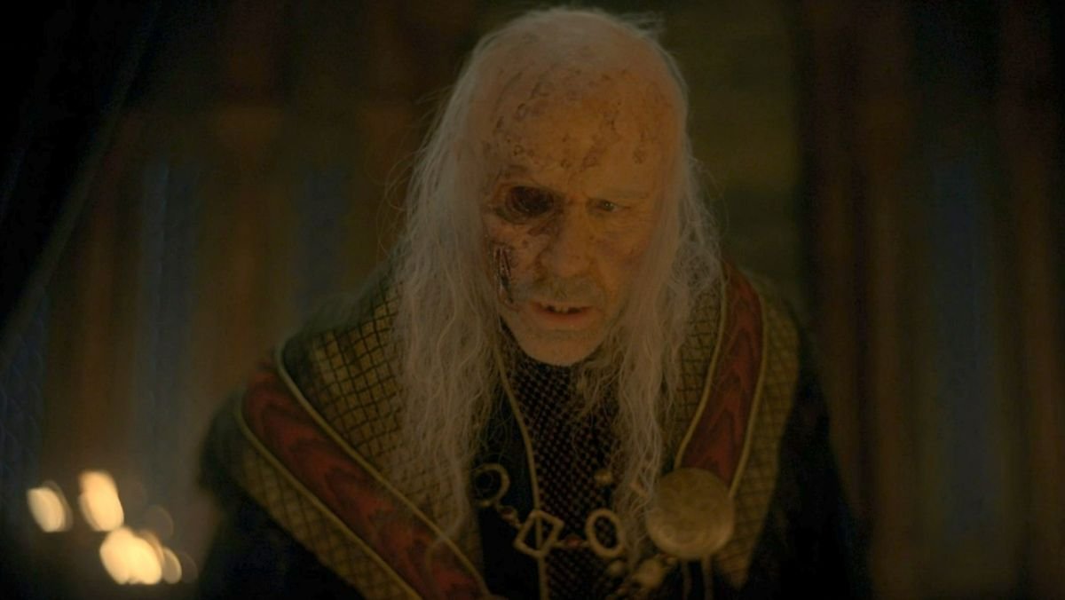House of the Dragon Viserys Gözü