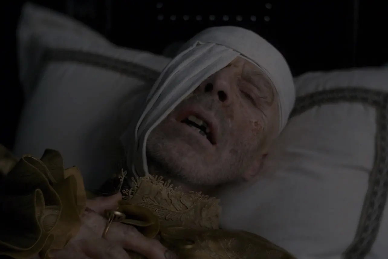 Viserys Neyin Acısını Çekiyordu?